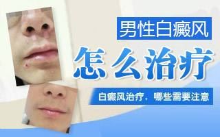 护理寻常型白癜风患者要注意什么